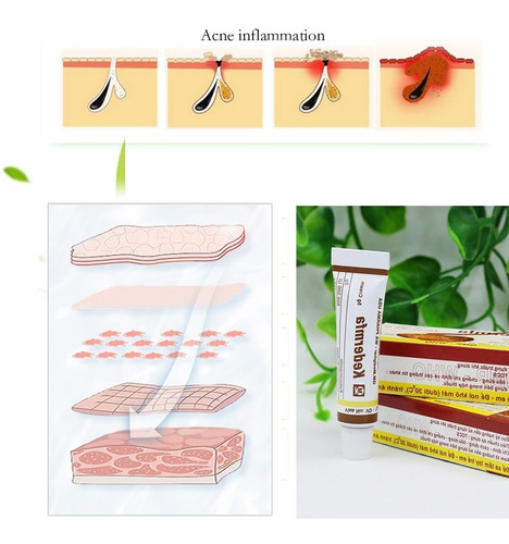 Orig Kedermfa Culebra Borra Arrugas Cicatrices Embarazo Acne