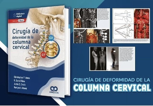CIRUGÍA DE DEFORMIDAD DE LA COLUMNA CERVICAL +e-Book, de C.P AMES y s., vol. 1. Editorial Amolca, tapa dura, edición 1 en español, 2022