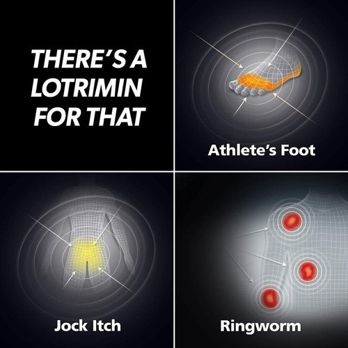 Lotrimin Ultra Antifungal Micose De Pele Pé De Atleta