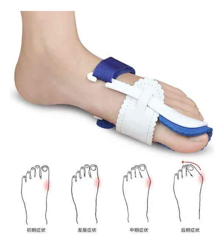 Corrector Progesivo De Juanete Dedo Pie Hallux Valgus Blanco