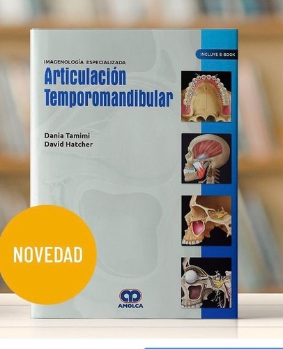 Imagenología Especializada. Articulación Temporomandibular