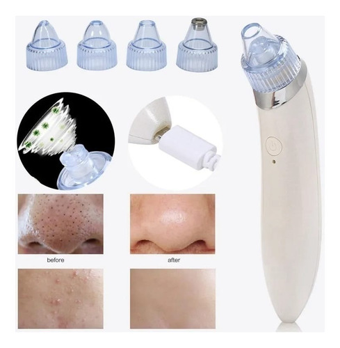 Removedor Extractor Puntos Negros Espinillas Limpieza Facial