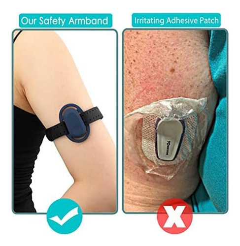 Cubiertas De Sensor Para Dexcom G6, Brazalete De Malla Trans