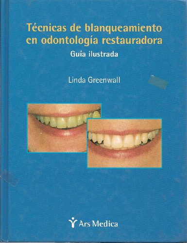 Libro Técnicas De Blanqueamiento En Odontología Restauradora