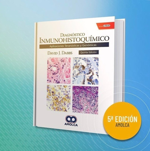 Diagnóstico Inmunohistoquímico  Aplicaciones Teranósticas Y 