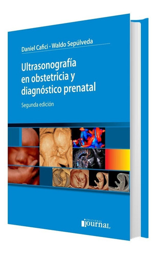 Ultrasonografia En Obstetricia Y Diagnostico Prenatal 2da Ed