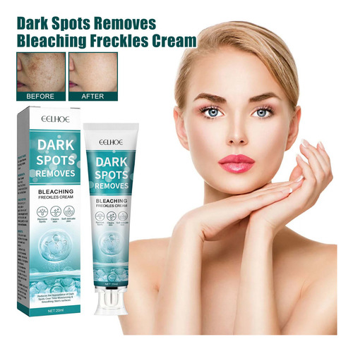 Crema Blanqueadora S Que Hidrata Y Humecta La Piel Whiteni