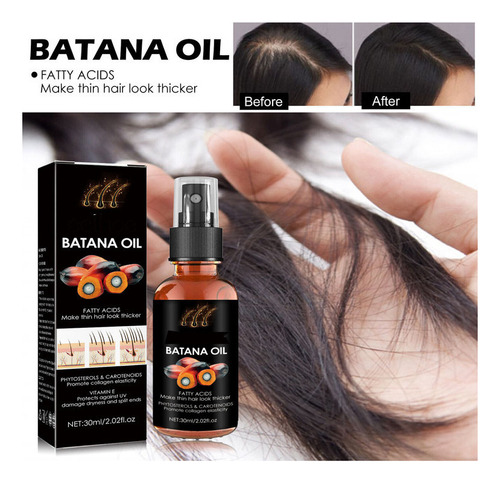 4 Botellas De Esencia Para El Crecimiento Del Cabello, Batan