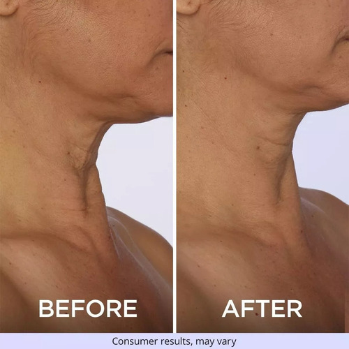 Crema Reafirmante De Cuello Gopure 1pcs