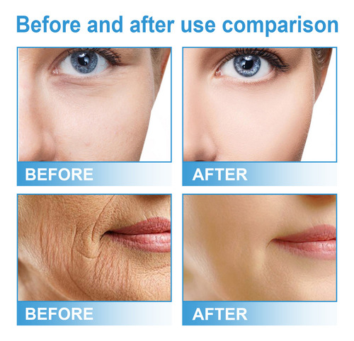 Gr Sérum Facial De Niacinamida