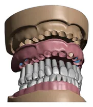 Comprar Colección De Modelos Dentales Maxilares Y Mandibulares