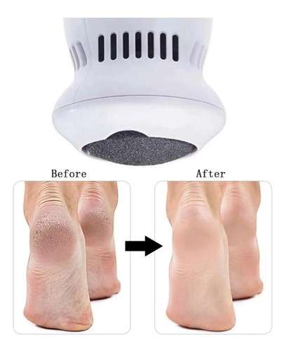 Imagen 9 de 10 de Removedor De Callos Pedicure Electrico Exfoliante De Pies