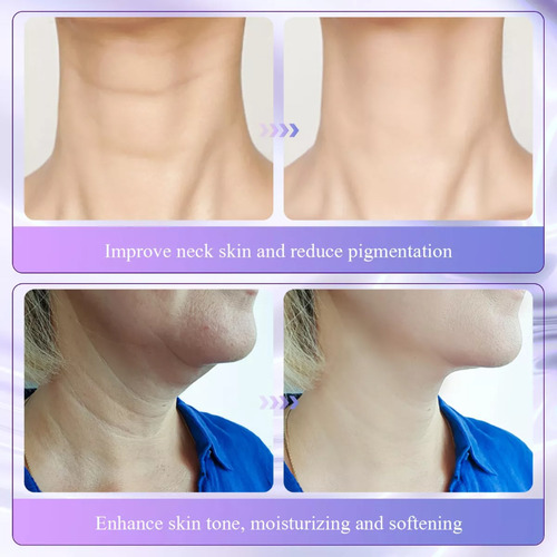 2 Pieces Collagen Firming Neck Cream, Wrinkles