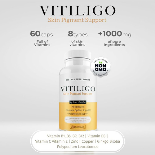 Support (vitiligo-skin Pigment Antioxidants Inmune 60 Cps