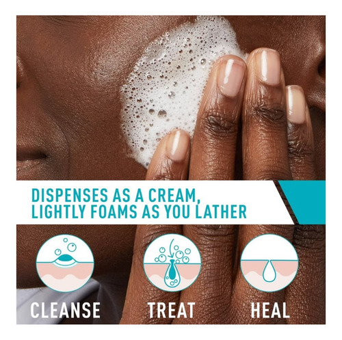 Cerave Cleanser Acné Espuma Limpiadora Para Control De Acné Acneica Día/noche