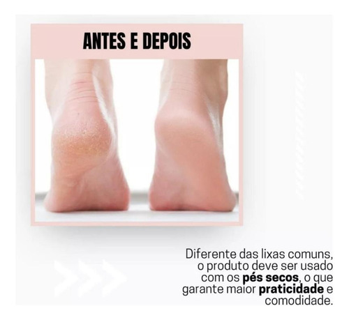Removedor Calos Elétrico Recarregável Portátil Pedicure E