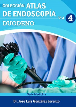 Atlas De Endoscopía. Volumen 4: Duodeno Dr. Jose Luis Gonza