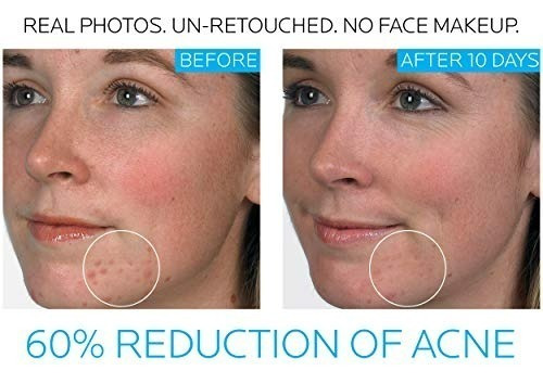 La Roche Posay Effaclar Adapaleno 0.1% Gel Tratamiento Acné