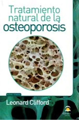 Osteoporosis Tratamiento Natural De La