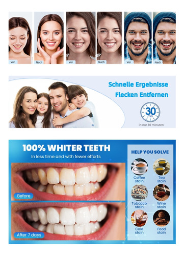 5 Cajas Con 14 Pares C/u De Teeth Whitening
