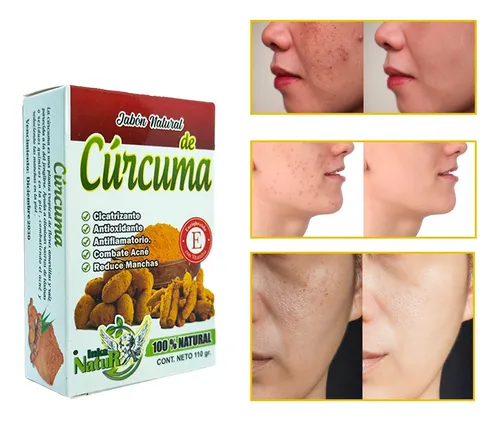 Jabón De Cúrcuma Activado 100% Artesanal Cuida Tu Piel