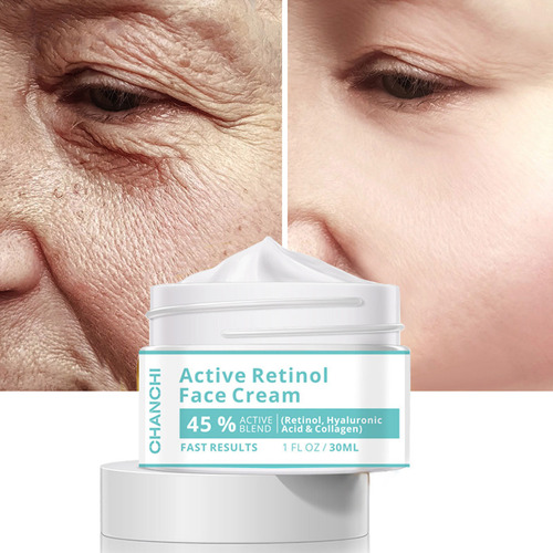 Creme De Clareamento Facial Active Retinol 30ml Creme Facial