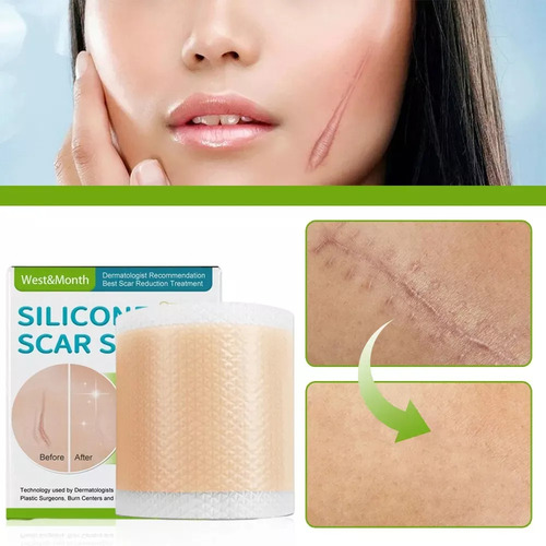 Silicona Cicatriz Abdominoplastia Dermo Cesarea Post Parto