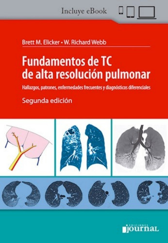 Fundamentos De Tc De Alta Resolución. Incluye Ebook. Journal