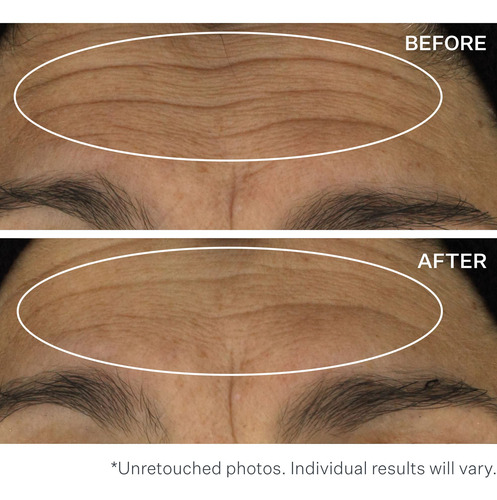 Sérum Strivectin Wrinkle Recode Line Transforming 30 Ml