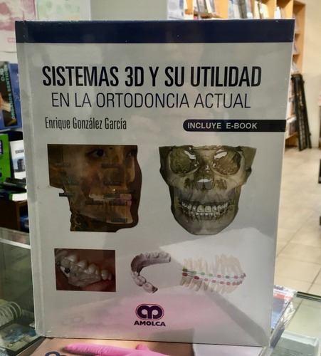 Sistemas 3d Y Su Utilidad En La Ortodoncia Actual,jk