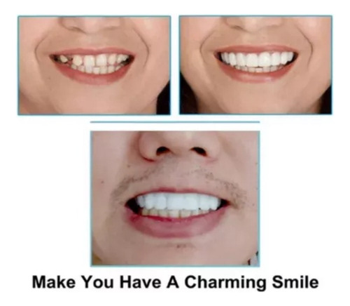 4box Carillas Dentales Ajustables Y Dentaduras Postizas