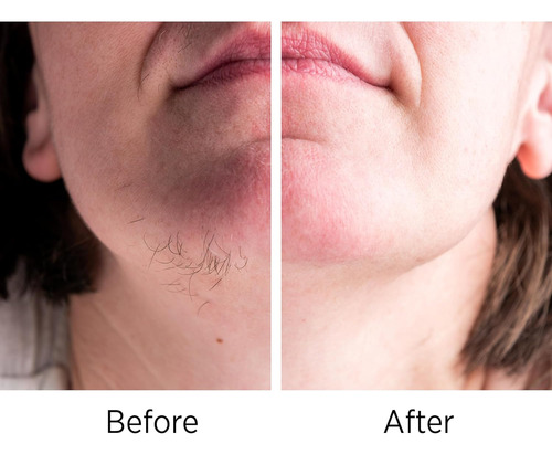 Vg Vogcrest Depiladora De Cejas - Vello Facial Mujer: Dep...