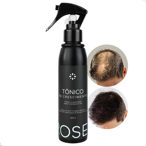 Tonico Poderoso Tratamento Capilar Para Crescer Cabelo