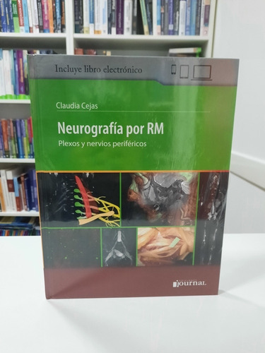 Neurografía Por Rm Claudia Cejas Envíos A Todo El País