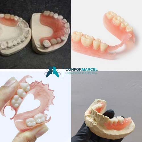 Imagen 8 de 10 de Prótesis Dentales Removibles Y Fijas