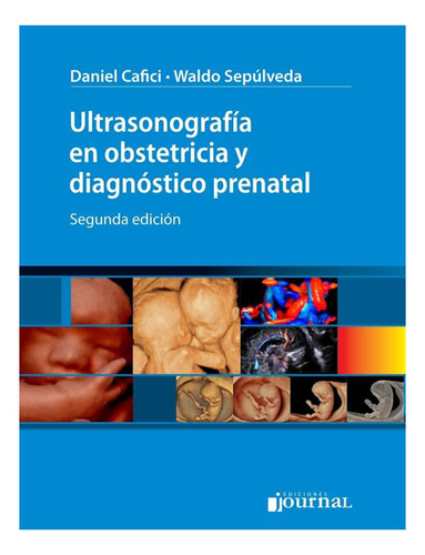 Ultrasonografia En Obstetricia Y Diagnostico Prenatal 2da Ed