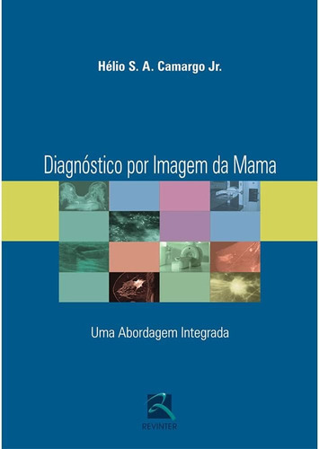 Diagnóstico Por Imagem Da Mama: Uma Abordagem Integrada 