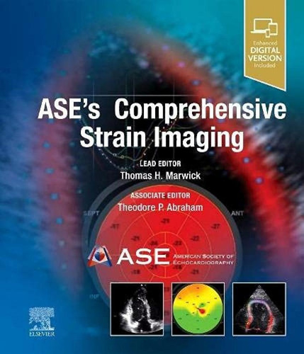 Libro: Ase´s Comprehensive Strain Imaging. Marwick/abraham. 