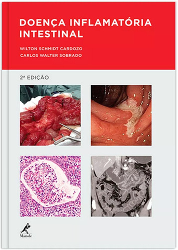 Doença inflamatória intestinal, de Cardozo, Wilton Schmidt. Editora Manole LTDA, capa dura em português, 2014