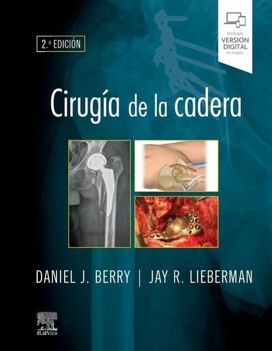 Cirugía De La Cadera 2da Edición, De Daniel Berry / Jay Lieberman. Editorial Elsevier, Tapa Dura En Español, 2021
