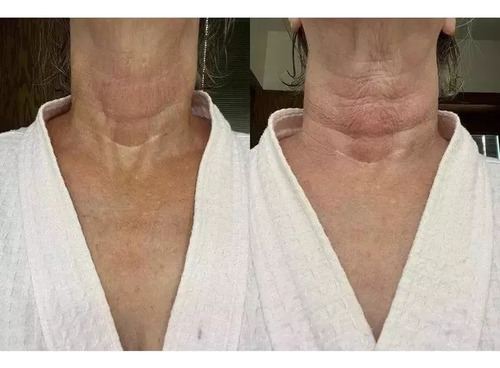 Crema For El Cuello Gopure - Crema Reafirmante For El