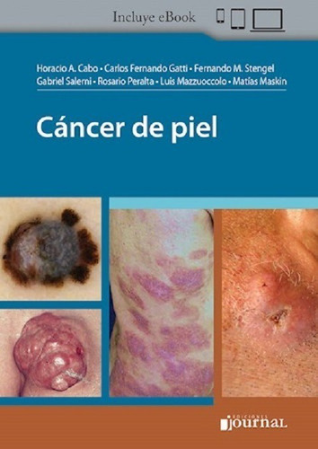 Cáncer De Piel - Cabo, Horacio (novedad)