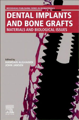 Dental Implants And Bone Grafts: Materials And Biological Issues, De Alghamdi, Hamdam. Editorial Woodhead Pub, Tapa Blanda En Inglés