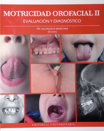 Motricidad Orofacial Ii. Evaluación Y Diagnostico, De Pia Villanueva Bianchini. Editorial Universitaria, Tapa Blanda En Español, 2021