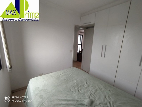 Imagem 16 de 30 de Apartamento - Ap00848 - 69547910
