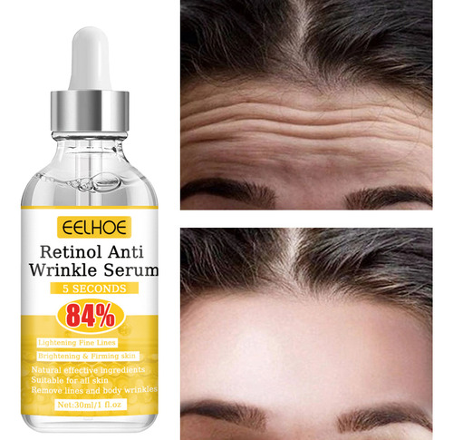 Removedor De Rugas Faciais, Lifting Instantâneo, Retinol, Sé