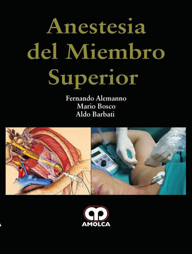 Anestesia Del Miembro Superior - Alemanno, F. - Bosco, M....