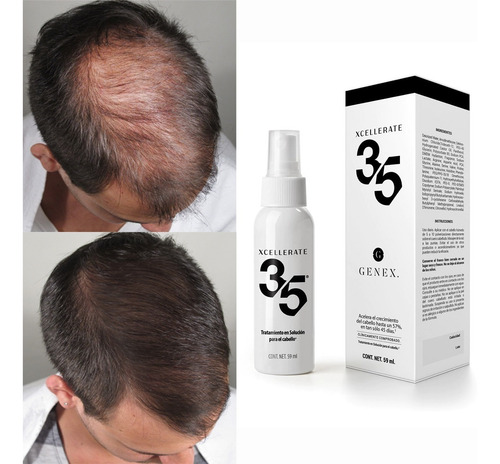 Xcellerate 35 + Shampoo Dht Genex 2 Pack Crecimiento Cabello