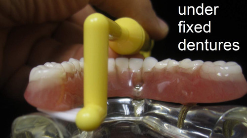 Cepillo De Dientes Implantclean Modelo Suave Para Implantes Color
