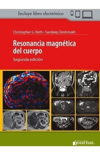 Roth Resonancia Magnética Del Cuerpo 2º/2018 Nue Env T/país